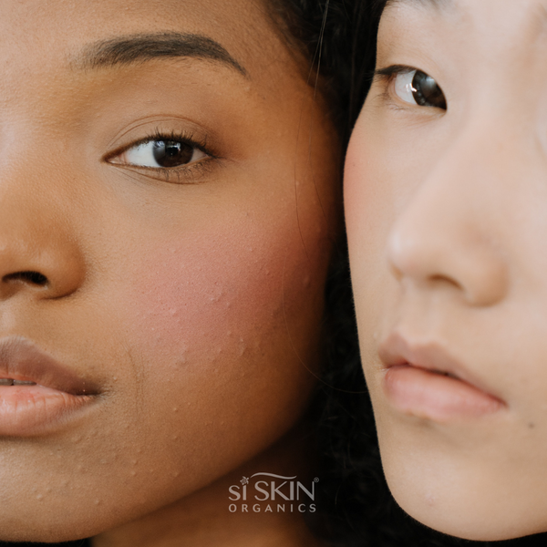 What Your Skin Is Trying To Tell You